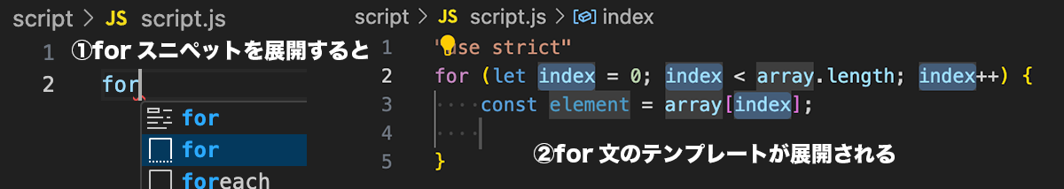 スニペットの展開